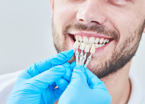 What’s the difference between porcelain and composite veneers?