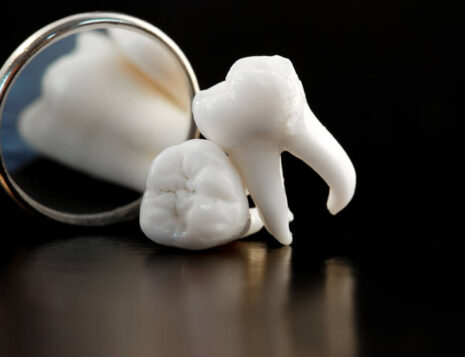 The Importance of Wisdom Teeth Evaluation in Teenagers and Young Adults